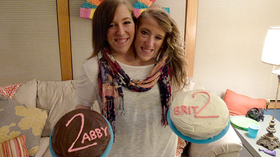 Abby e Brittany Hensel, um dos casos de gêmeos siameses mais conhecidos pelo mundo.