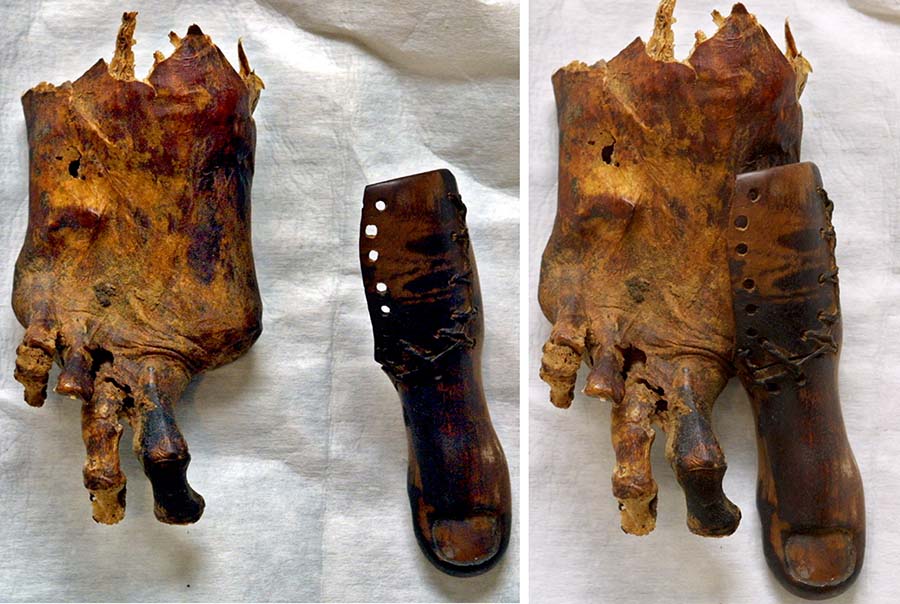 múmia-prótese