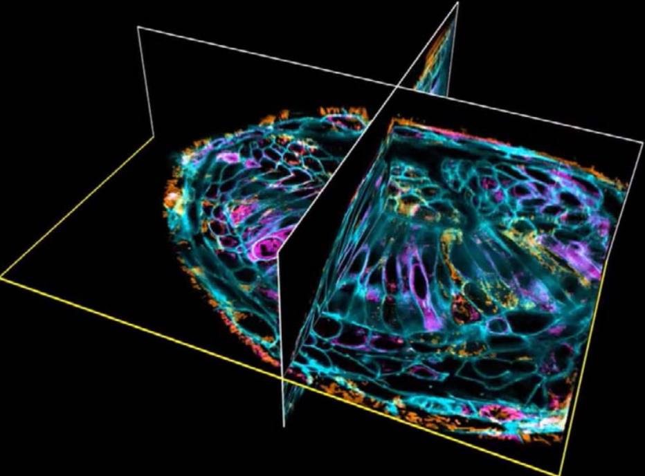 (Com o novo microscópio, os cientistas observaram a dinâmica das organelas celulares de um olho de peixe paulistinha: membrana plasmática [verde], retículo endoplasmático [rosa]e mitocôndrias [marrom]. Foto: Eric Betzig / Science)