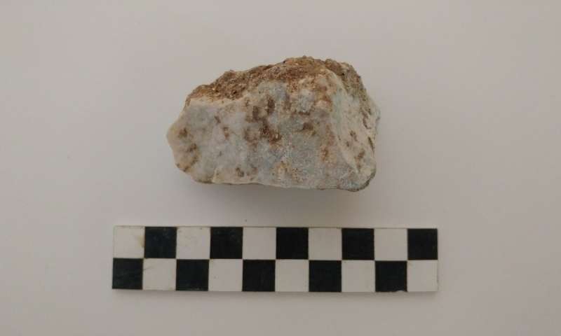A pedra encontrada na boca do menino. Fonte: Universidade de Stanford