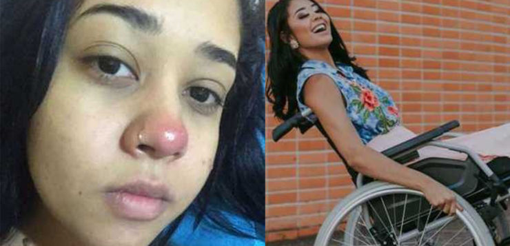 A história da jovem que ficou paraplégica por causa de um piercing